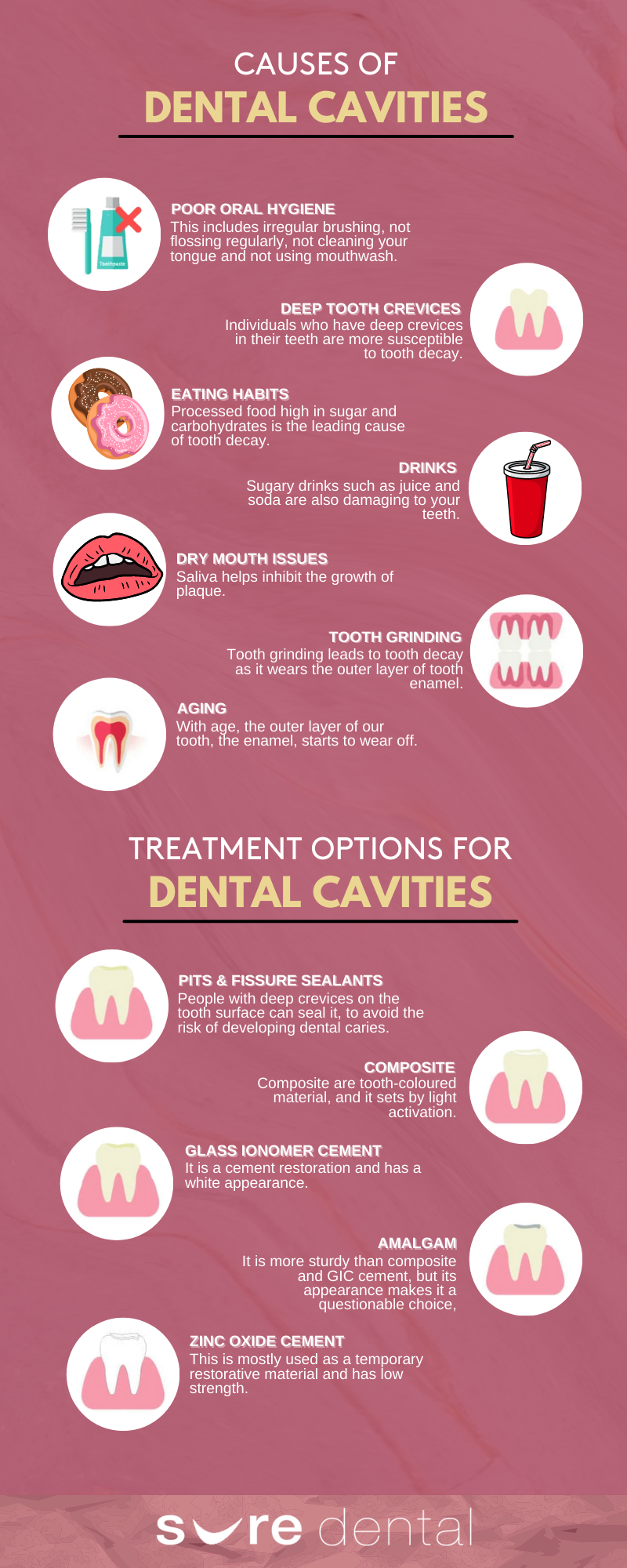 What Causes Cavities Between Teeth Dental Cavities Between Teeth AKFWJX