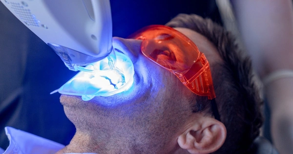 Is Zoom Whitening Painful Or Unpleasant