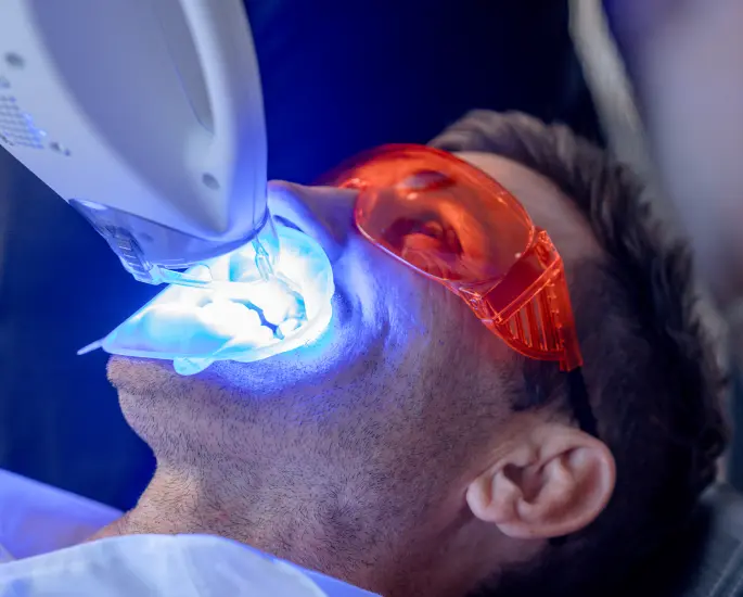 Our-Technology_Philips-Zoom-Teeth-Whitening