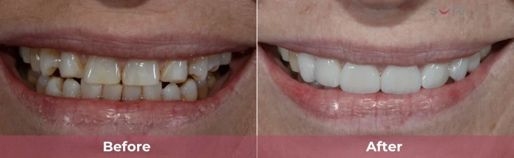 Sure-dental Wooloowin Anne-m