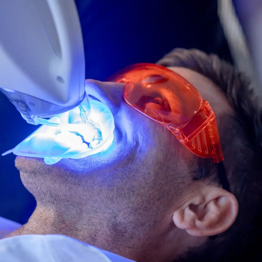 Teeth Whitening Brisbane North, Wavell Heights
