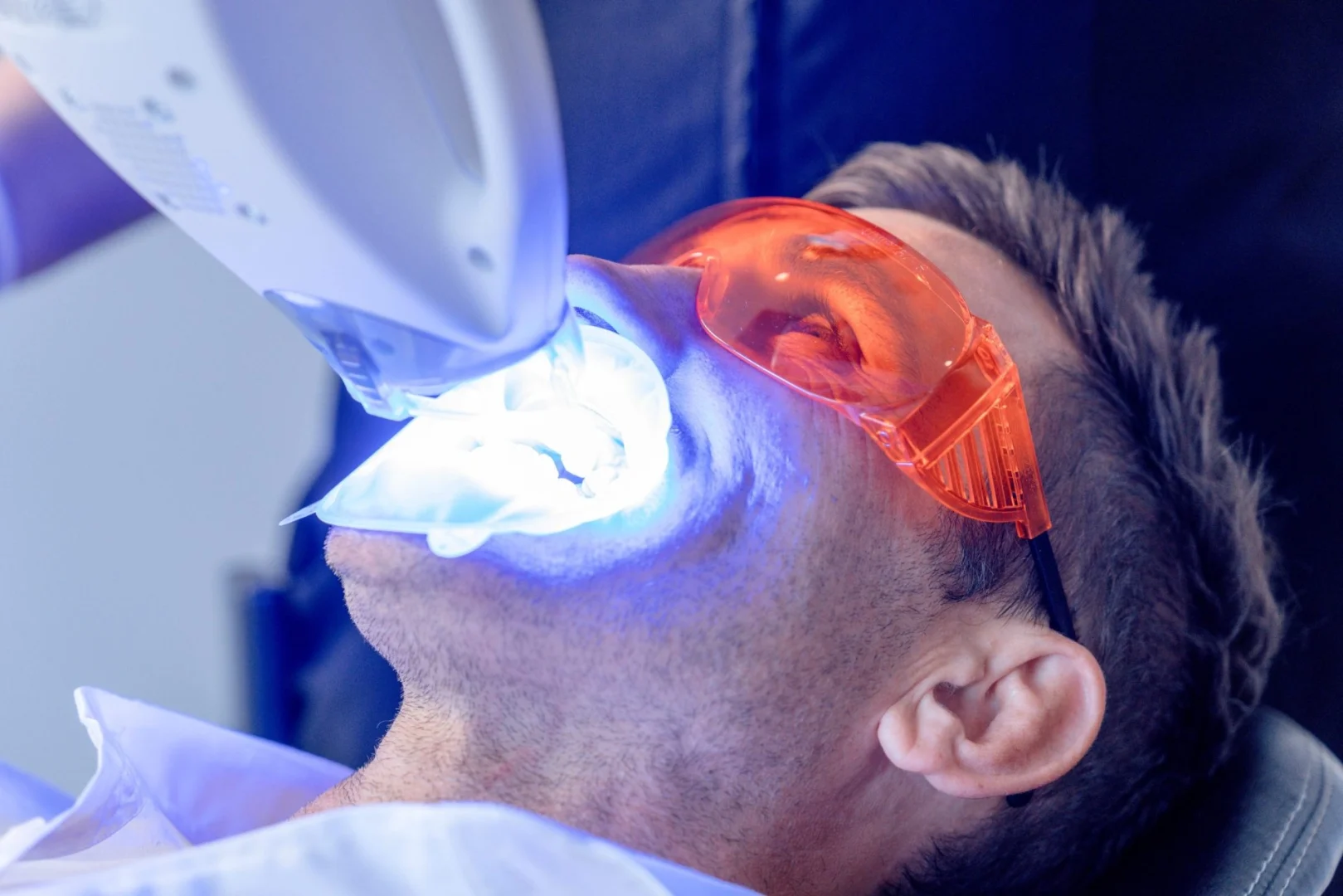 Cosmetic Dentist Near Stafford Qld